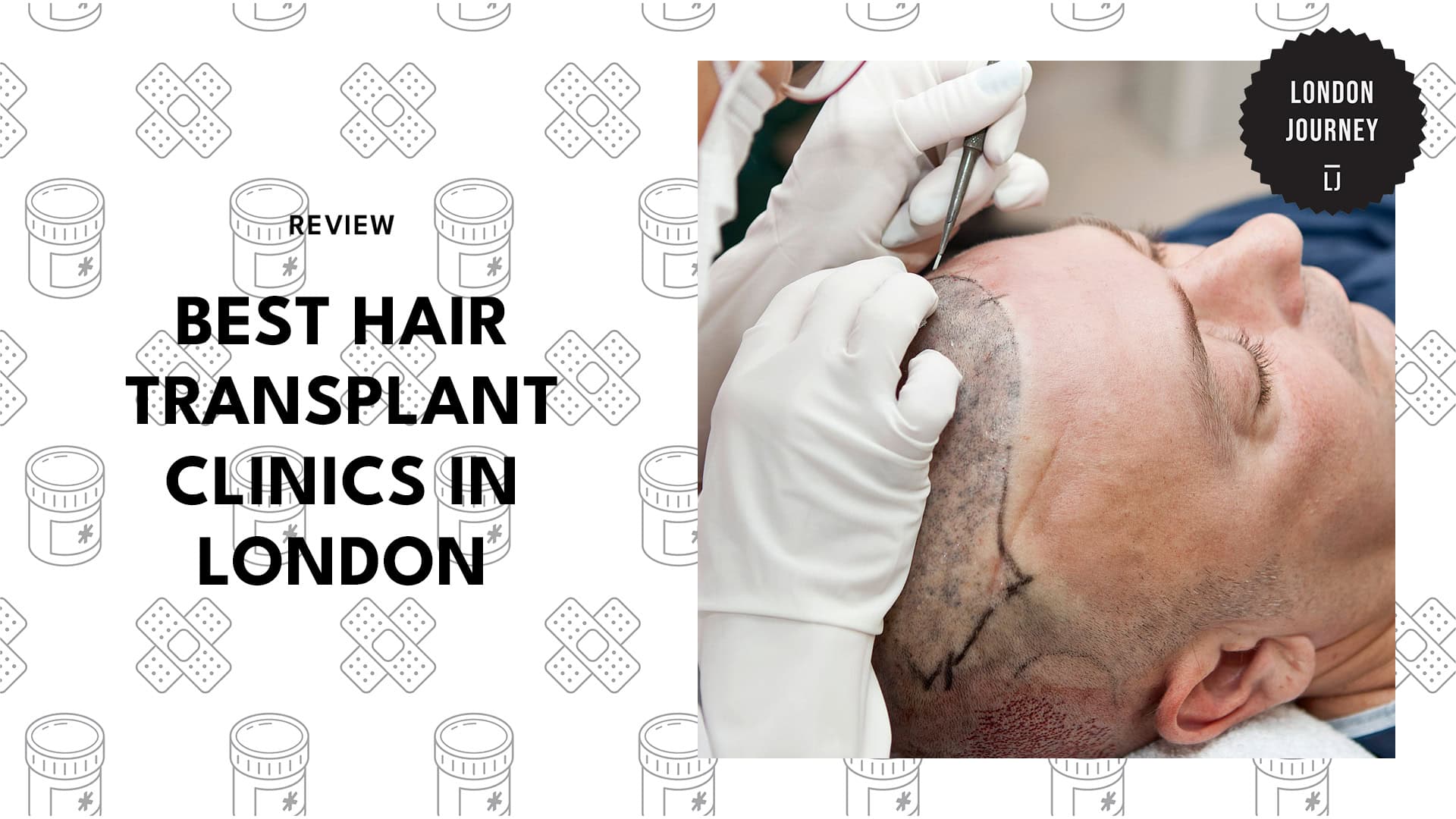 hair-transplant-london