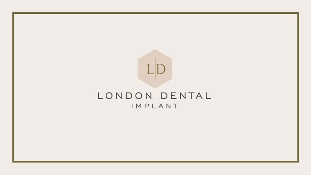 london-dental-implant